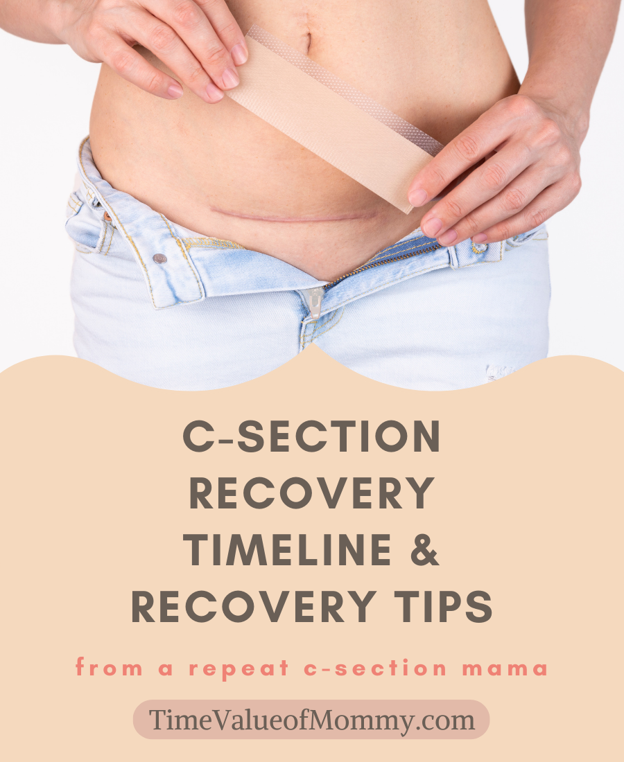C-Section Recovery: Timeline and Tips